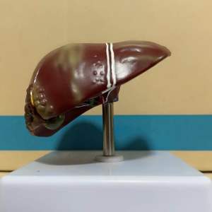 เลซิติน เลตินแท้ ของใหม่ ส่งฟรี ยาเลซิติน เลซิติน1200มก บำรุงตับ หัวใจ ความดัน ลดไขมัน อ้วน ของแท้ กิฟ ฟา รีน เลซิตินแท้ เลซิตินแท้ ราคา - Lazada