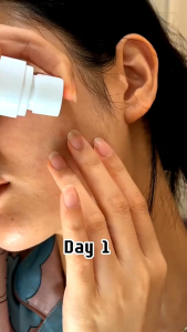 Skintific 10% Niacinamide Brightening Serum 20ml