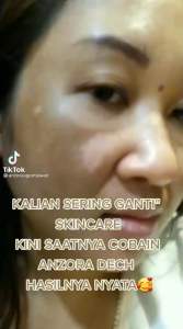 PAKET RENEWAL ANZORA PAKET FLEK ANZORA CUSHION ANZORA BEDAK ANZORA CREAM ANZORA SERUM ANZORA SUNSCREEN ANZORA SUNSCREEN BBF CREAM MATA ANZORA CREAM LEHER ANZORA HANDBODY ANZORA BODY LOTION ANZORA SKINCARE RED JELLY ANZORA SERUM MUTIARA ANZORA GARUT KOTA