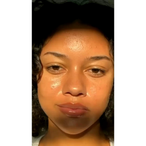 ACNE PATCH BENTUK LUCU FLOWER LOVE BEAR