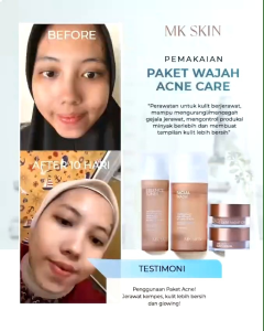 MKSKIN ACNE SERIES
