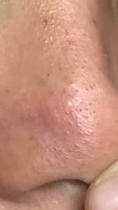 FEALI Blackhead Remover Mask Step1 Peel Off Free Kertas & Step2 Pore Serum | Masker Komedo Step 1 & step 2 Serum | FEALI BLACKEAD REMOVAL NOSE MUD MASKER WAJAH NEW