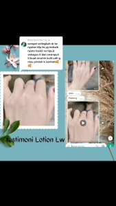 PAKET LOTION BOOSTER TONER mencerahkan LW SKINCARE