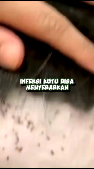 PEMBASMI KUTU HEWAN 500ml | Obat Anti Kutu Kucing