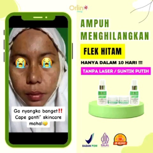 Facial Wash Toner Flek Membantu Membersihkan Wajah Flek Hitam Bandel