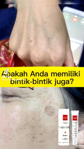 COD Youbuy Blemish Whitening Ori Freckle Cream: Salep Penghilang Flek Hitam