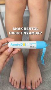 Aunty Dot Soothing Dot Roll-On - Gatal Reda Kurang Dari 10 Minit - 100% Original - Ready Stock - Free Gift - Safe Packing Baby