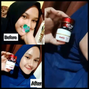SERUM PREMIUM BY RK GLOW