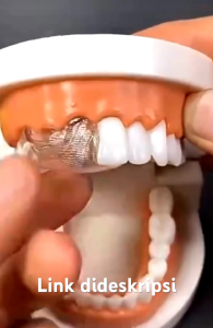 Temptooth isi 500 butir untuk penambal gigi ompong patah