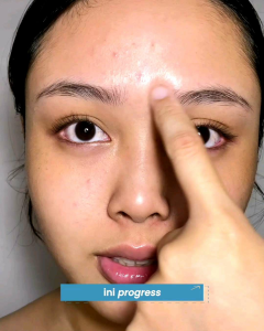 LUME Brightening Serum Concentrate Booster untuk mencerahkan kulit dan mengunci kelembapan kulit. Menutrisi dan menghidrasi kulit sehingga kulit segar terawat. Membersihkan pori memperbaiki skin barrier dan texture kulit yang rusak