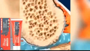 BỘ ĐÔI 2 HỘP -DẦU NÓNG HÀN QUỐC 100ML+1 HỘP GEL KHỚP GỐI 120G