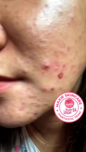 1 Paket Skincare Maxie Bpom ORI Garansi Uang Kembali Jika Palsu