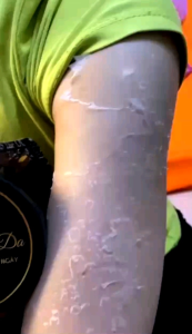 KEM TÁI TẠO DA BODY