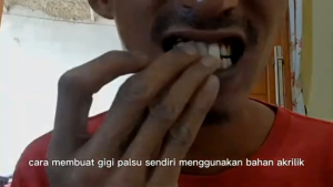 PAKET PASANG GIGI AKRILIK MANUAL LENGKAP