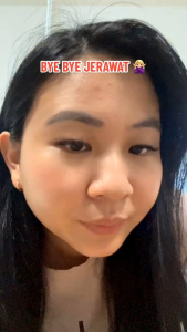 NUface Acne Spot Gel 15gr