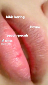 SR12 Lip Serum - Lip Glow Serum SR12 - Magic Colour Lip Serum SR12 - Lip Serum Magic Colour Pencerah Bibir Hitam SR12