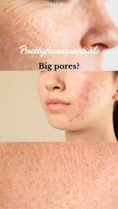 Salicylic Acid Whitening Facial Scrub Deep Cleansing Gently Exfoliating Oil Control & Brightening
