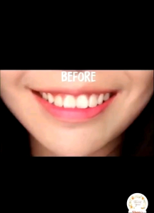CHÍNH HÃNG FULL BOX Bột Trắng Răng Than Tre Hoạt Tính Teeth Whitening Natul - Mẫu mới
