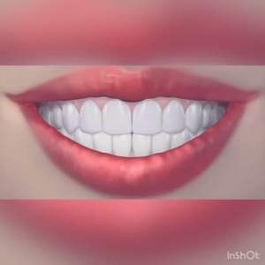 GUM® Proxabrush® Permanent Handle With Tight Moderate & Wide Go-Betweens® Heads / 8-pc Refills