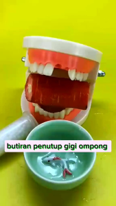 Temptooth: Penambal Gigi Ompong, Patah, dan Renggang Isi 600 Butir