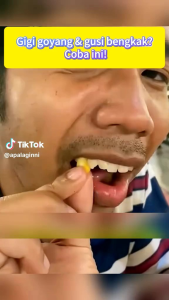 Pasta Gigi Pemutih dan Perontok Karang Gigi - Pemutih Gigi Kuning Permanen Ampuh Viral di Pembersih Gigi Biar Putih / Pencegah Gigi Berlubang 120g