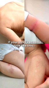 ZeHo MicroAg+ Cream | 40G | EXP: 06/29 | Krim ZeHo MicroAg+ | Dry skin cream | Ceramide cream |