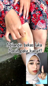 Paket Hemat Adera Refil Collagen Serum 3 pcs Bpom Original Penghilang Bekas Luka Dan Mengembalikan Kesehatan Kulit Noda Hitam Kerutan