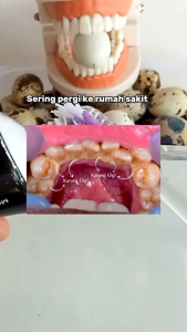 Pasta Gigi Charcoal SR12 dari Bubuk Arang Memutihkan & Menghilangkan Plak / Karang Gigi