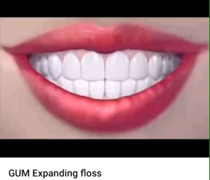 ไหมขัดฟันรุ่น Expanding ขนาด 40 เมตร ยี่ห้อ กัม (GUM) รายละเอียดคุณลักษณะเฉพาะ - ไหมชัดฟันเป็นแบบเส้นเส้นใยออกแบบพิเศษ เมื่อสัมผัสน้ำ หรือนำลาย ตัวไหมชัดฟันจะพองขึ้น เพื่อช่วย กำจัดคราบแบคที่เรียระหว่างฟัน และใต้ร่องเหงือก อันเป็นบ่อเกิดของโรคฟันผุ