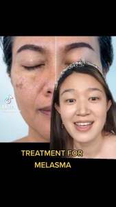 Eternal Serum Melasma Wrinkle Anti Aging Mixtrue Beauty Mild Retinol Serum