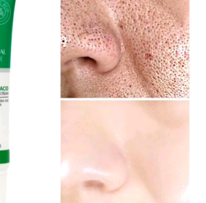 BPOM CINDYNAL Cream Penghilang Pori-Pori Ampuh Cream Salicylic Acid 20ml
