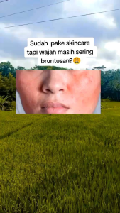 🎀🆔MILK CLEANSER DRWSKINCARE 🆓AKSESORIES