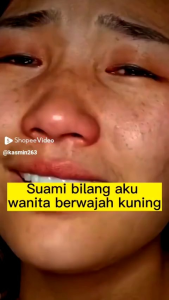 YOUBUY Whitening Blemish And Freckle Removing Cream Penghilang Flek Hitam