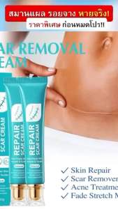 1 ชิ้น ครีมทา คีรอยด์ ลบรอยแผลเป็น ของแท้ พร้อมส่งในไทย 179 บาท