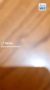 Acnemed Blemish Spot 12 gr [ Gel Membantu Merawat Bekas Jerawat Menyamarkan Bintik Hitam Akibat Jerawat dan Mengontrol Minyak Berlebih Mengandung Salicylic Acid Aloe Vera Panthenol Niacinamide dan Allium Cepa Extract Obat Jerawat Wajah Muka ]