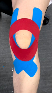 Tapping Kinesiology Tape 5M × 5CM Olahraga Original Therapy Perban Plaster Elastis Pelindung Cidera