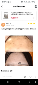 PEELLING UNTUK JERAWAT FLEK DAN BRUNTUSAN BPOM