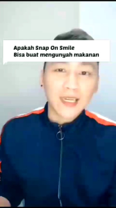(BISA COD) SNAP ON SMILE VENER PERAIH GUGI AUTHENTIC ATAS DAN BAWAH ORIGINAL