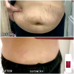 SUISMERA 燃脂纤体霜