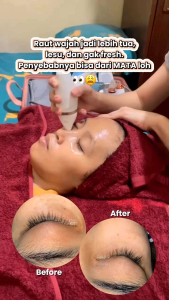 Galvanic Spa Nu / Alat Setrika Wajah