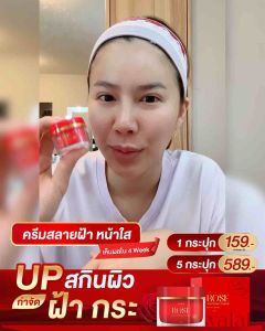 โปรสุดคุ้ม💝 ครีมกุหลาบ + สบู่กุหลาบ Walai Rose whitening cream บำรุงผิว ชะลอวัย สิว ฝ้ากระ มีสารต้านอนุมูลอิสระ ใช้แล้วหน้าเด็ก ปรับสภาพผิวแห้งเหี่ยว ให้กลับมาดูสุขภาพดี