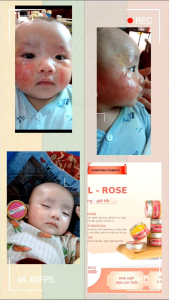 Kem nghệ đa năng Mulrose (Hồng Tâm cosmetics)