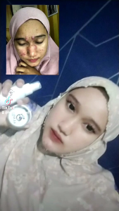 PAKET ALOVA SKINCARE FARMASI/BPOM BONUS SERUM
