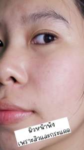 (3 หลอด) VIVONTE ครีม ลด รอย ดำ จุด ด่าง ดำ รอย สิว เพิ่มความฉ่ำโกลว์ กระฝ้าฝังลึก หลัง เลเซอร์ ชนิดมีแผล WHITENING AND SPOT CORRECTOR 20 GM