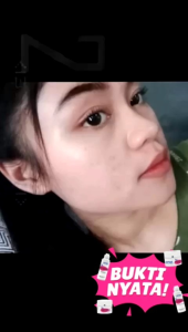 Paket Layna Skincare BPOM Free Bonus