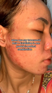 POMEGLOW ESSENCE TONER EXFOLIATING
