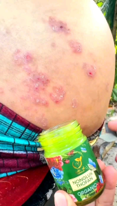 1 แถม 1 บาล์มนงลักษณ์ ออแกนิก NONGLUK กลิ่นหอมสดชื่นสมุนไพร