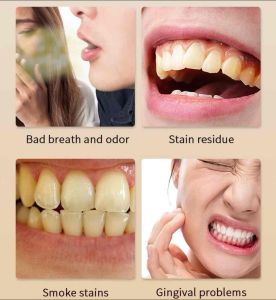 ยาสีฟันขิงขิง ยาสีฟันสมุนไพร ลดกลิ่นปาก ฟันขาว ฟันแข็งแรง ทำให้ปากสดชื่น Toothpaste 50g(T53)