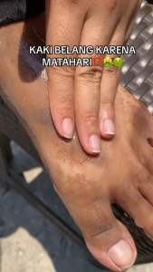 SALSA Hans Jebb Perontok Daki Peeling Gel Exfoliating Gel Skin Cleaner dan Exfo Wajah Salsa 110gr