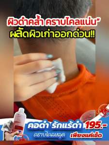 โทนเนอร์ไลยา 1ขวด195.- ขจัดคราบ ขี้ไคลฝังลึก คอดำ ข้อศอกดำ ตาตุ่มดำ